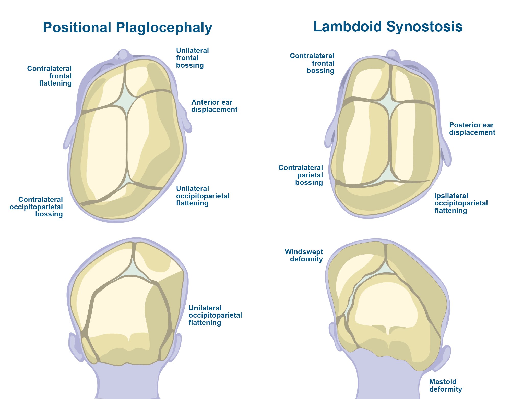 Medical_Images_4_craniofacial_syndromes