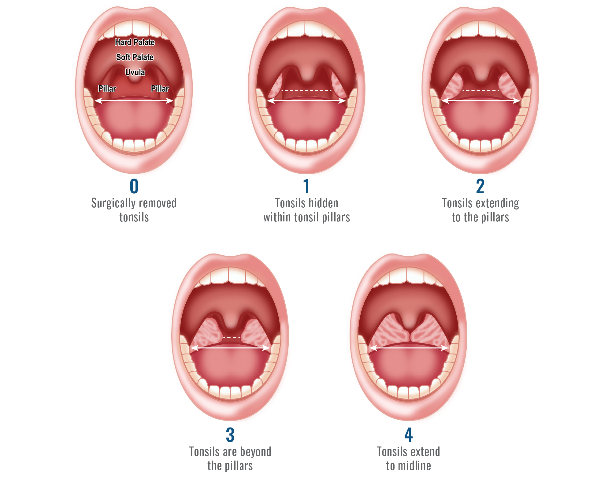 Medical_Images_5_mallampti_images