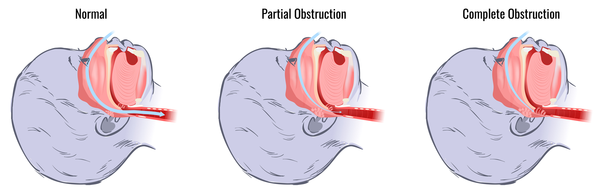 Medical_Images_7_pediatric_osa