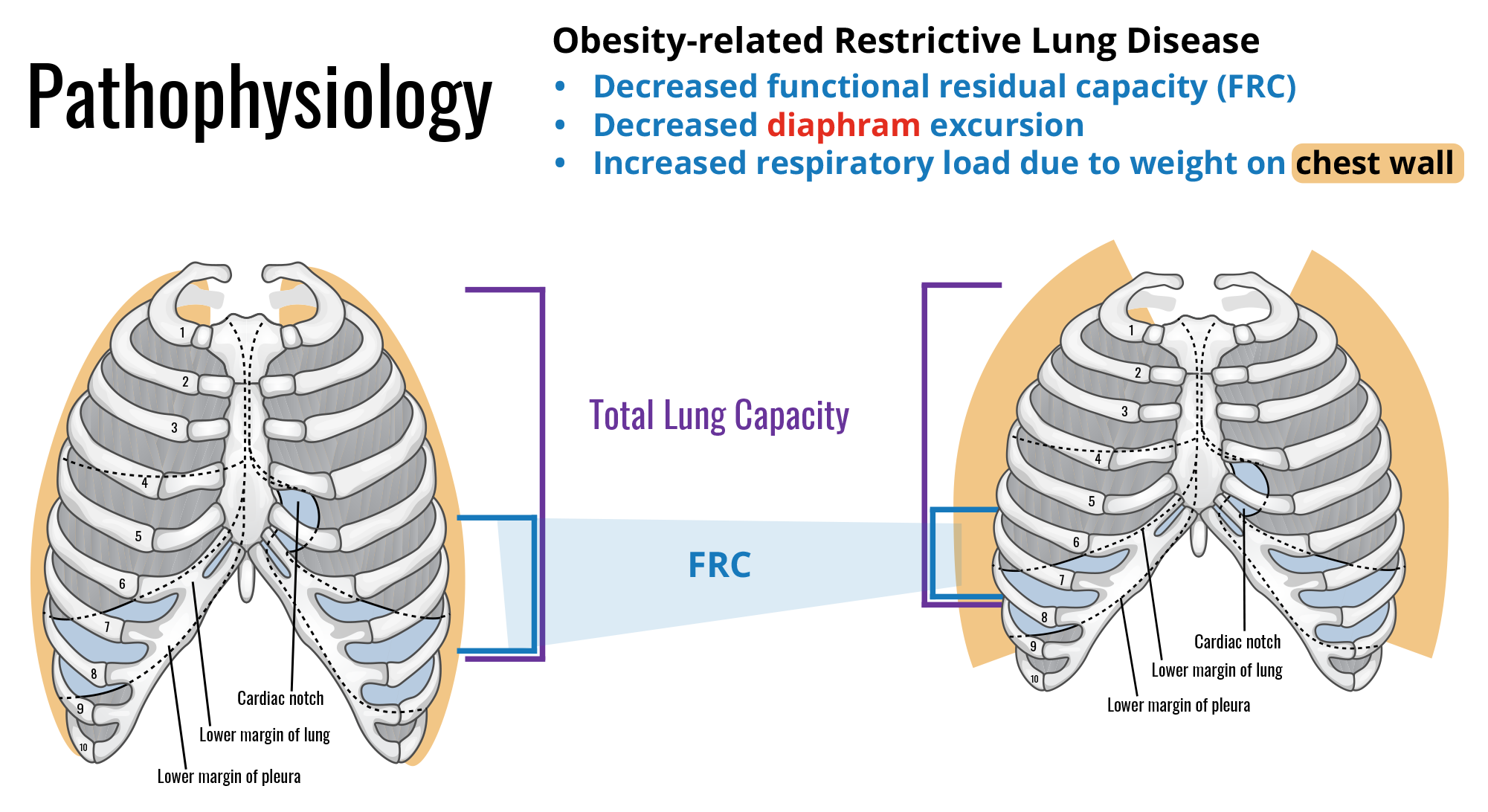 Medical_Images_8_restrictive_lung_disease